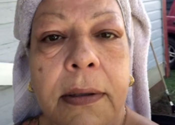 Vídeo sobre creme para tirar bolsa debaixo dos olhos  viraliza: é visto por 23 milhões