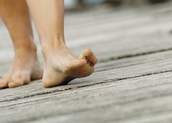 Fascite plantar: uma dor na sola do pé, como se estivesse pisando em agulhas