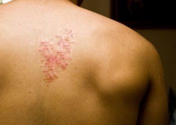 Vacinas que você precisa tomar após os 50