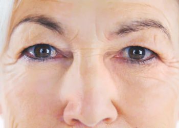 Sem óculos: a libertadora cirurgia de catarata