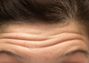 Como retardar o surgimento de rugas